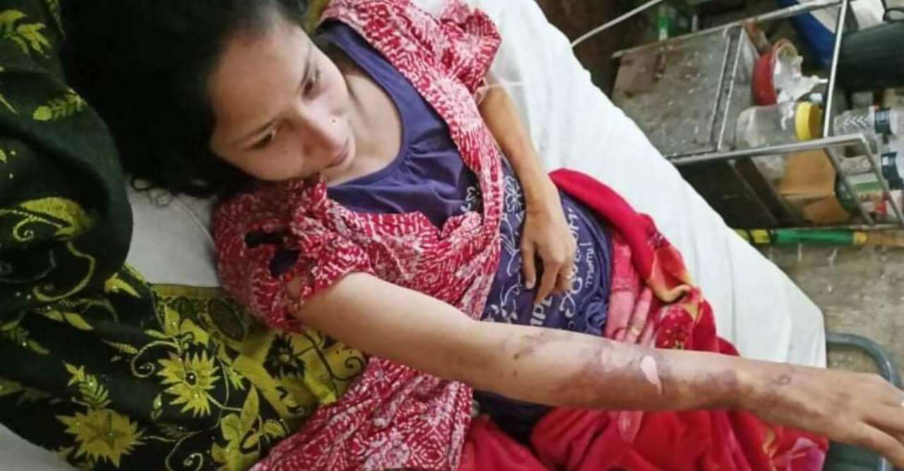 গুরুদাসপুরে দুই বোনকে মারধর ও পুড়িয়ে হত্যা চেষ্টার অভিযোগ
